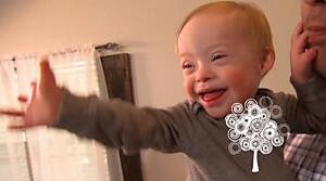 This year's Gerber baby has Down syndrome